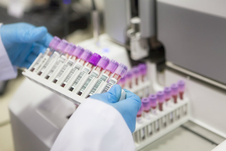 Dasa compra laboratórios Salomão e Zoppi (iStock)