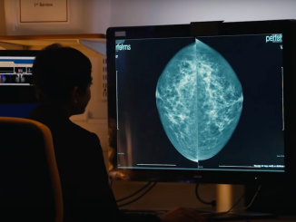 Imagem de uma médica analisando uma mamografia em um monitor