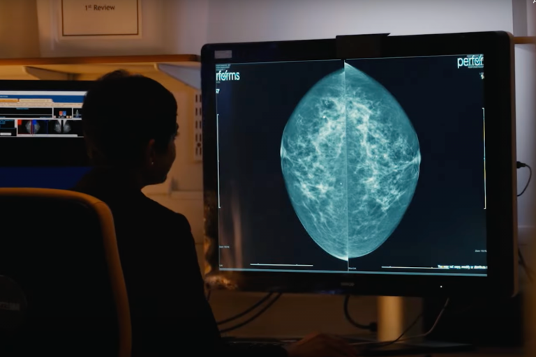 Imagem de uma médica analisando uma mamografia em um monitor