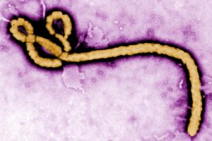 vírus ebola