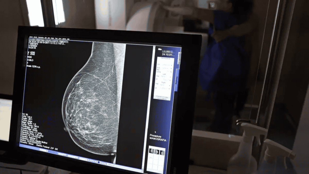 Entenda: Médicos Lançam Guia para Evitar Recusa de Mamografia Digital